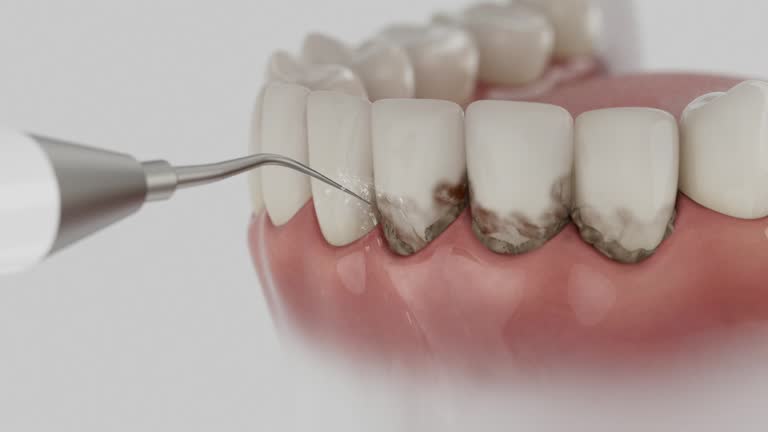 Reliable Teeth Cleaning And Checkup contractor in Pike County County, MO by Dentist Open Now